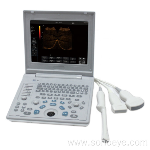 Sonostar SS-6B Ultrasound Machine Better Than SS-7